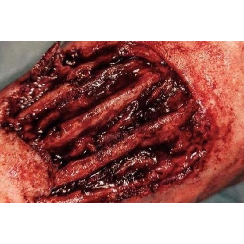Exposed Hand Ligaments Prosthetic